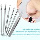 Petrel S57 Chimocee Blackhead Remover Tools Professional Surgical Pack 611702570588