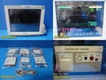 Philips MP70 (M8007A) Patient Monitor W/ Mms+print Modules & New Leads 36840. Fixed Price $644.99.